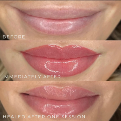lip blush cosmetic tattoo result at Maison Montclair