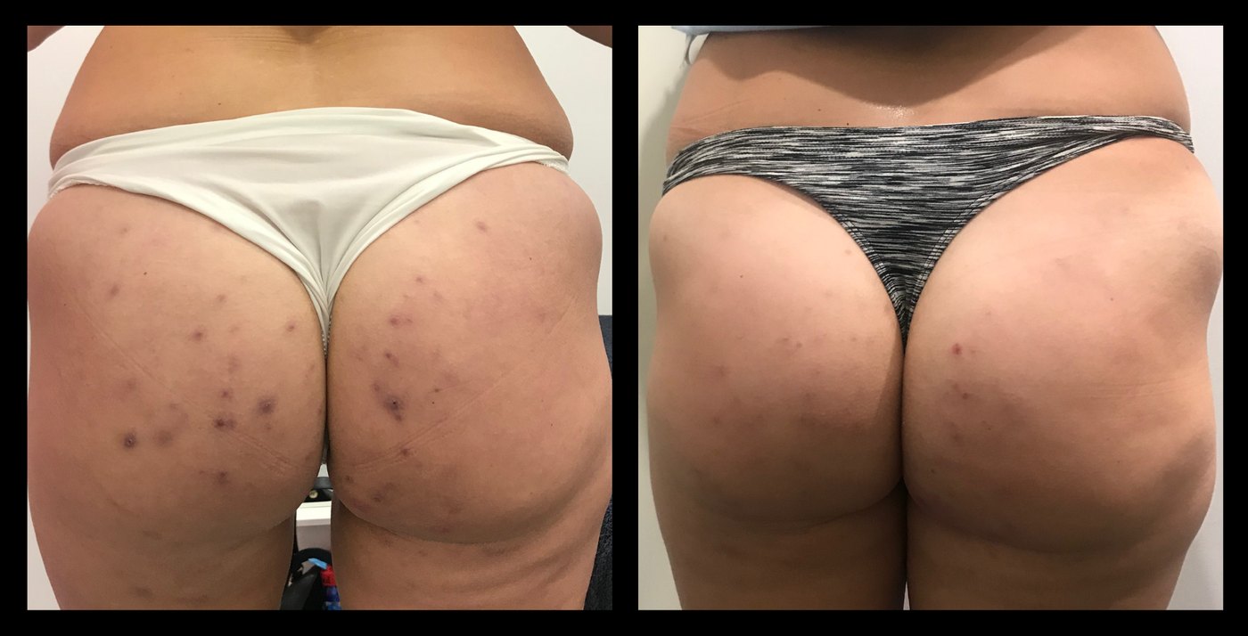 MediLUX LED before and after