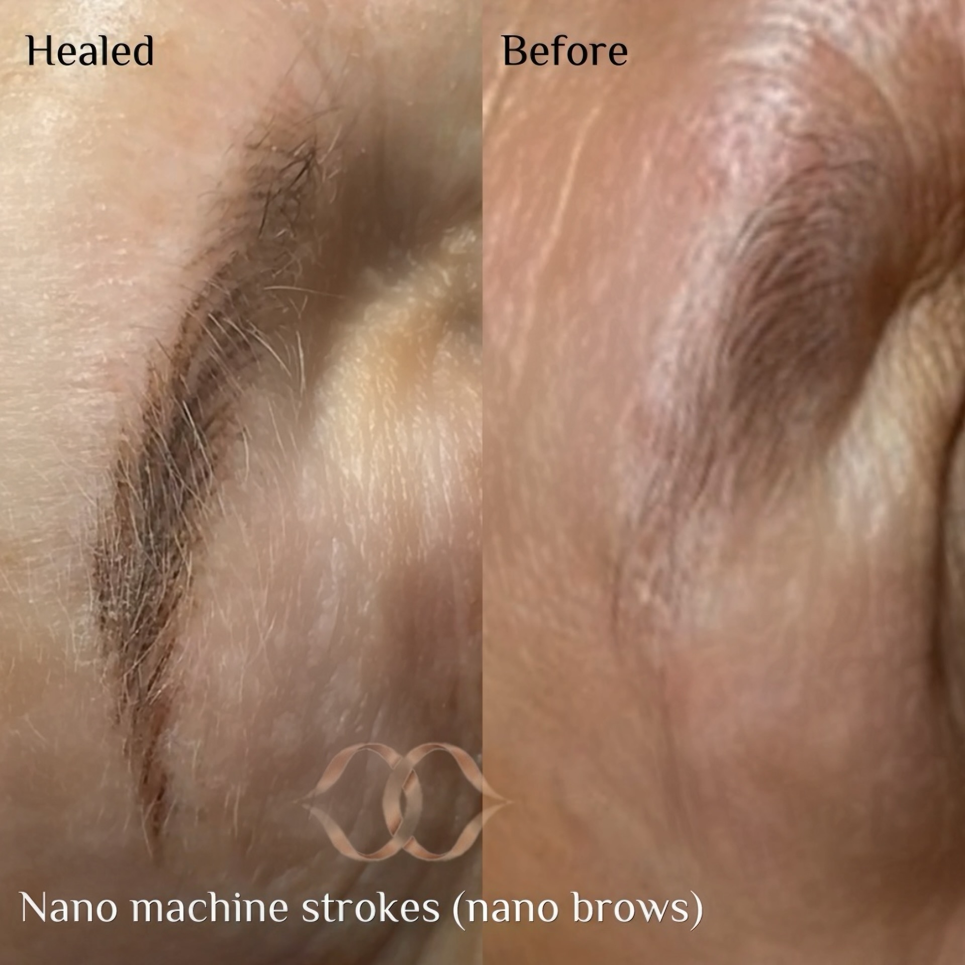 best nano brows sydney, healed results