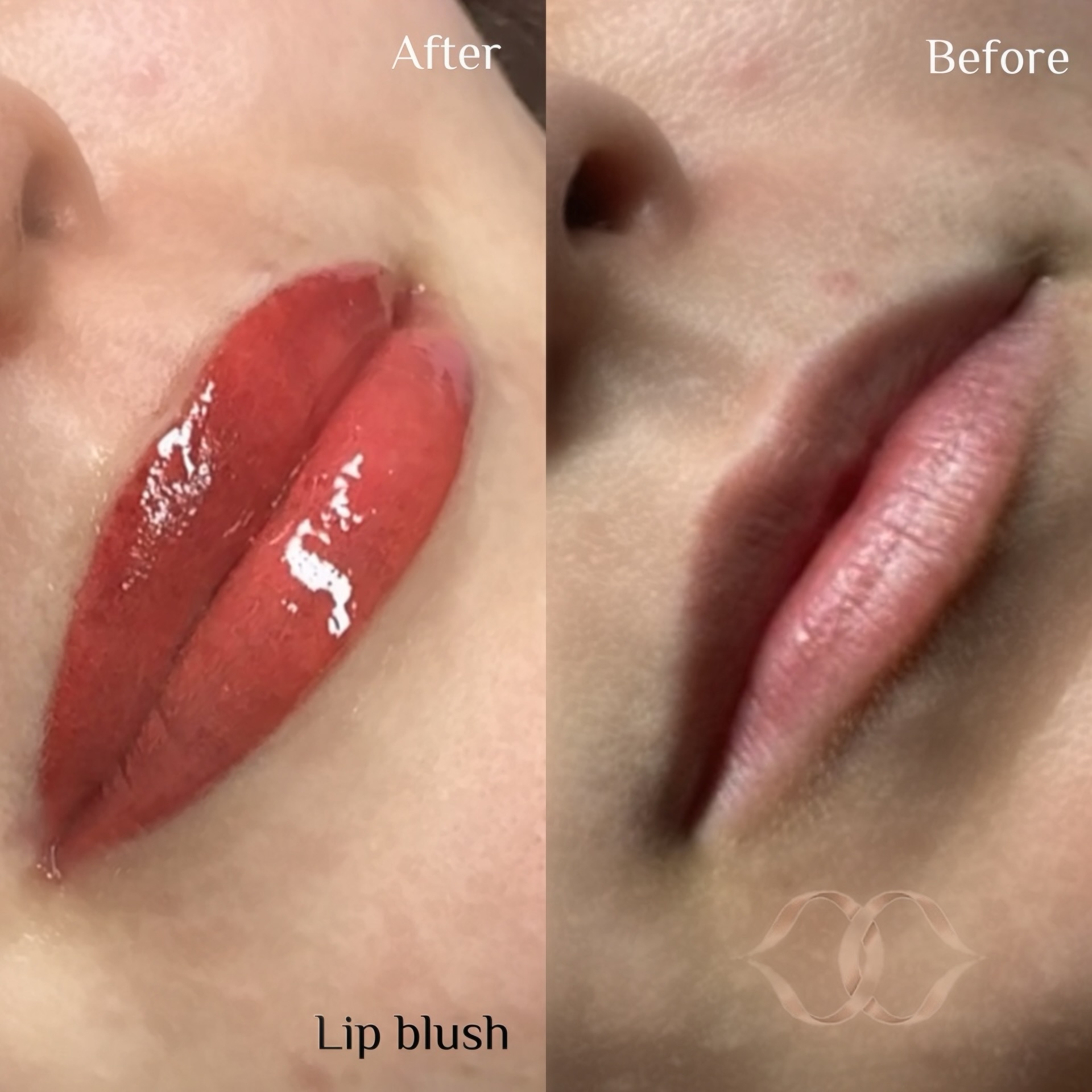 Best lip blush cosmetic tattoo Northern beaches sydney